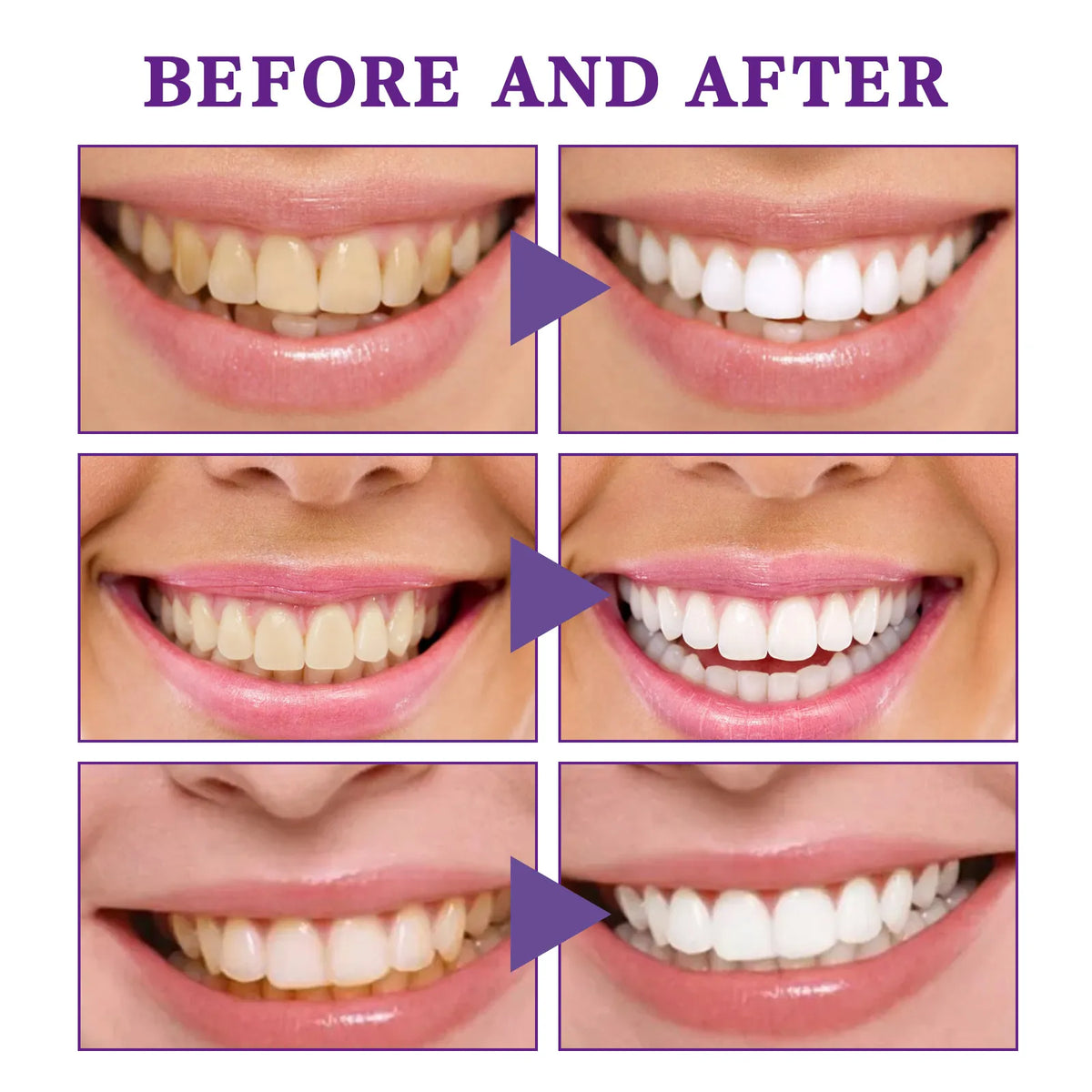 V34 Tooth Cleaning Mousse - Blue Cup LLC.